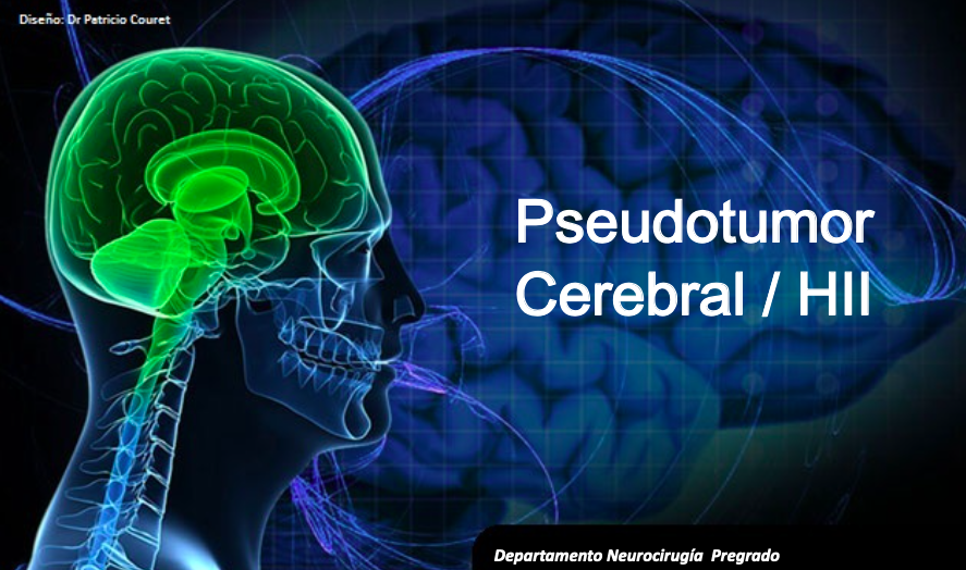 pseudotumor-cerebral